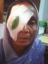 A patient after a free cataract operation.