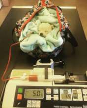 Raducu receiving a blood transfusion