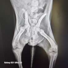 Stripes broken pelvis