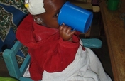Feeding 300 Severely Malnourished Children.