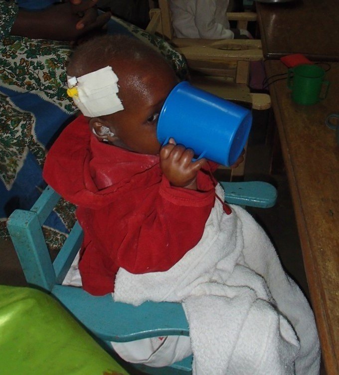 Feeding 300 Severely Malnourished Children.