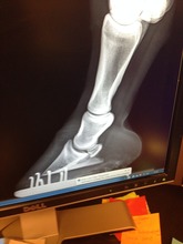 A normal hoof and coffin bone x-ray