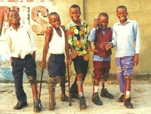 Treatment for 100 youth with disabilities in Congo