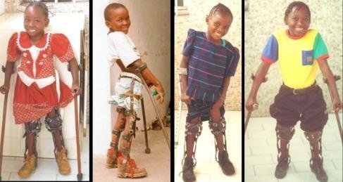 Treatment for 100 youth with disabilities in Congo