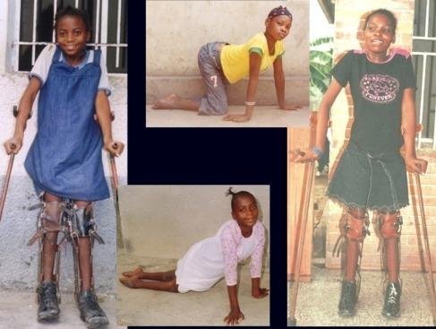 Treatment for 100 youth with disabilities in Congo