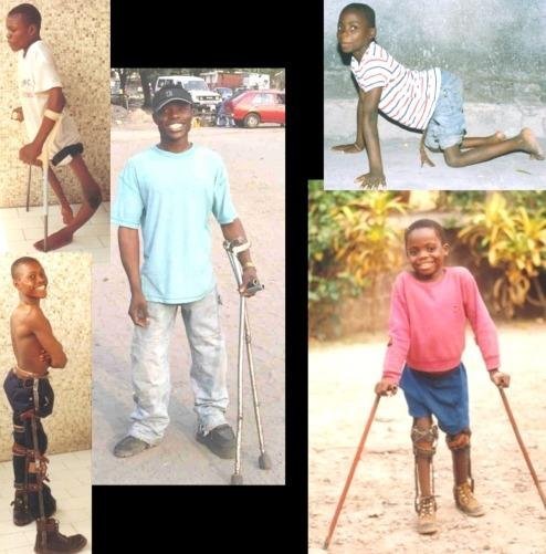 Treatment for 100 youth with disabilities in Congo