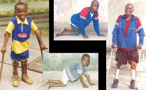 Treatment for 100 youth with disabilities in Congo