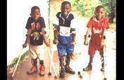 Treatment for 100 youth with disabilities in Congo