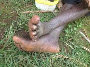 Maria's legs before being washed