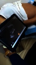 Using the ultrasound unit to do an exam