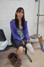 Luz when she first approached us for a prosthesis