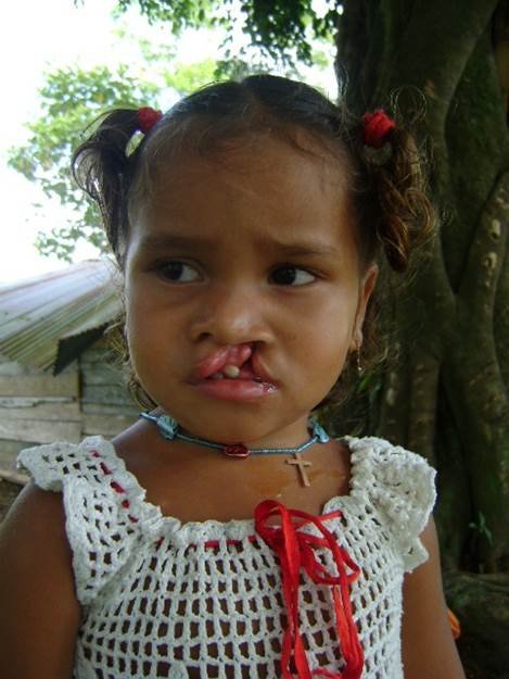 Give A New Smile to 20 Children in Uraba, Colombia