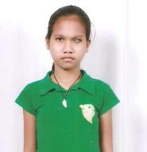 She is Judy Ann Salazar before the operation