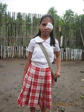 After Judy Ann's eye operation