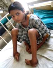 Birmala before treatment