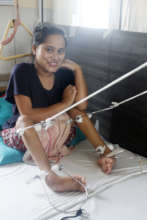 The skeletal traction that realigned her legs.