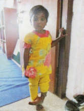 Sakhina before treatment