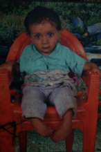 Nilesh Before Treatment