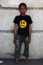 Nilesh Standing Tall After Treatment