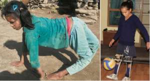Before and after - now Shanti even plays soccer!