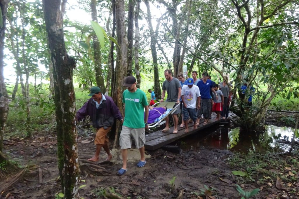 Emergency extraction: acute appendicitis