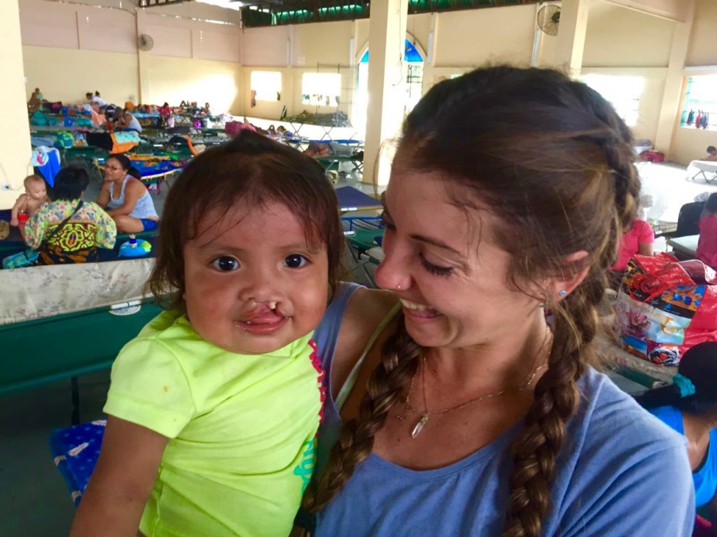 Partner with Operation Smile: Cleft Lip/Palate