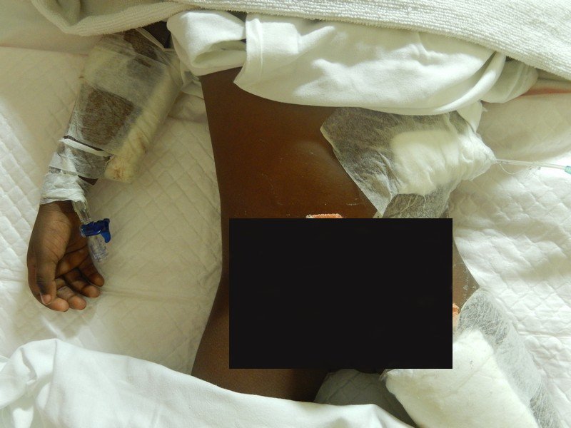 Surgery Care