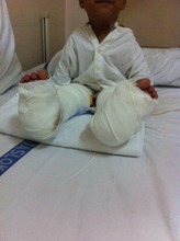 Shreya after her surgery