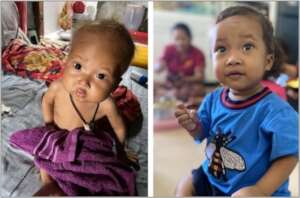 Before and after joining MT's Baby Care Program