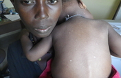 Help Us Stop the Ebola Crisis in Sierra Leone