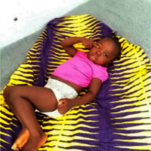 Baby Treated at IHI Clinic