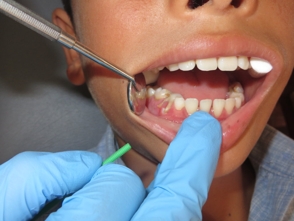 Bolivian boy receives dental treatment