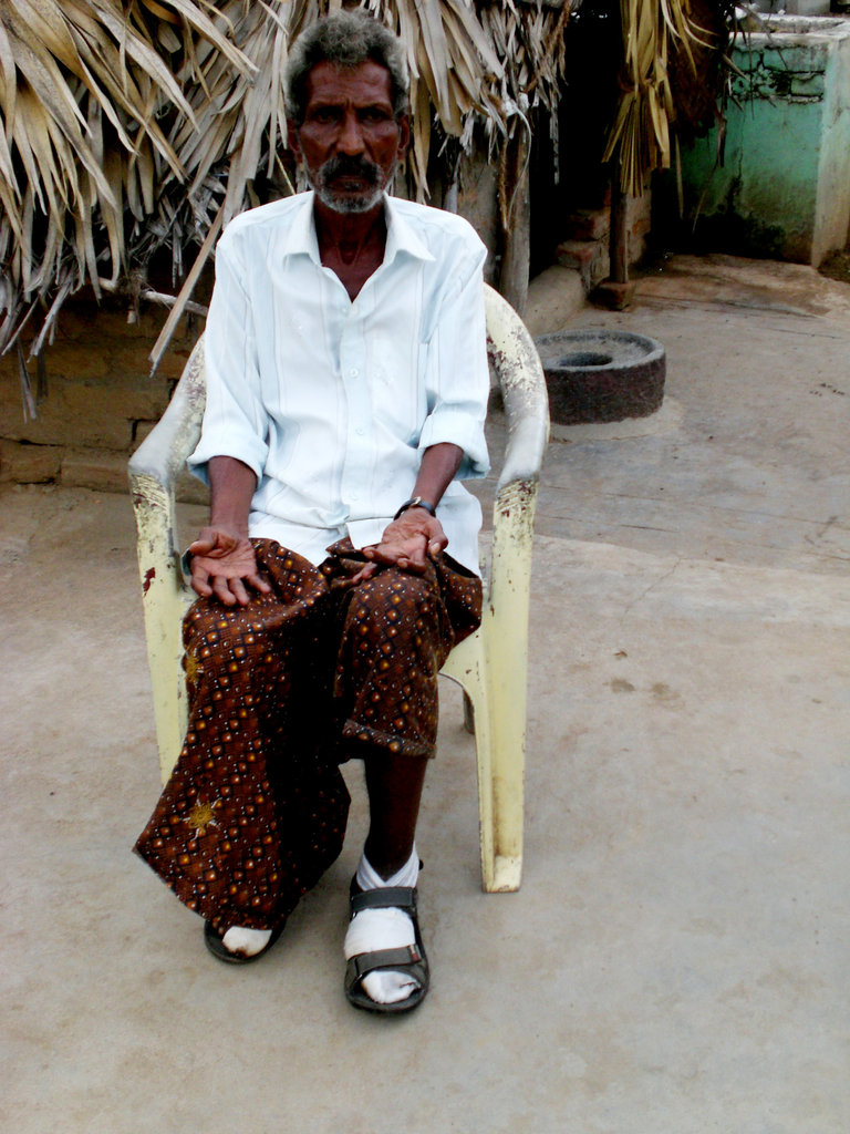 Deformed Leper & poor disable youth therapy Centre