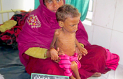 To Save Severe Malnourished Children in Bihar.