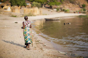 (The HIV status of this lady is unknown)