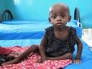 Keep 50 malnourished children alive in Uganda