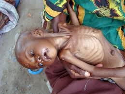Keep 50 malnourished children alive in Uganda