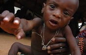 Keep 50 malnourished children alive in Uganda