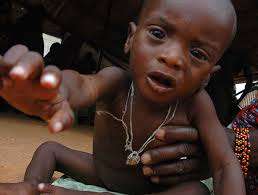 Keep 50 malnourished children alive in Uganda
