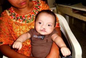 Fredy before his surgery