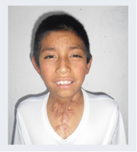 Gregorio when first seen