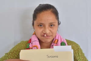 Susana Before Surgery
