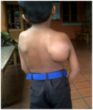 Walter before his surgery