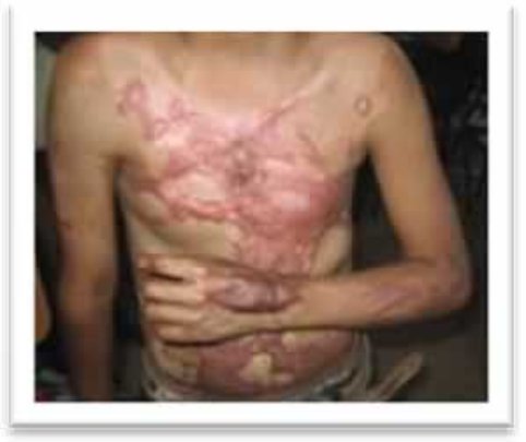 Maynor before surgery