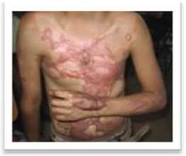 Maynor before surgery