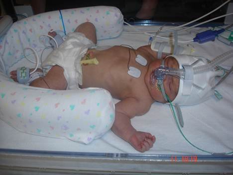 Preventing life threatening infection in UK babies