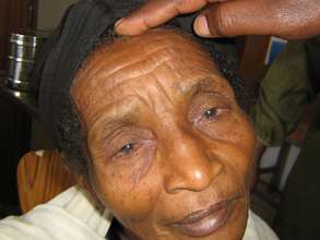 Amina before surgery