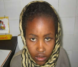 Abaynesh after surgery