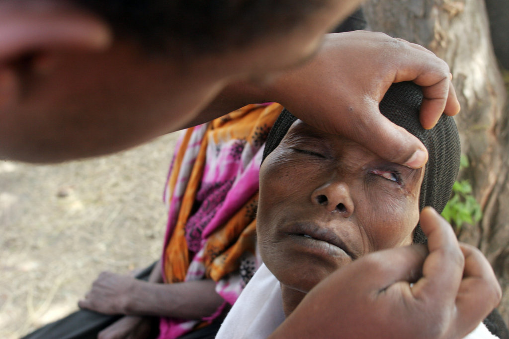 Simple Surgery to restore Sight to Ethiopians