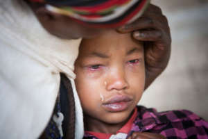 Asegedech suffered excruciating pain